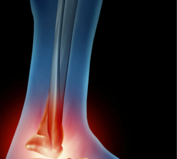 [Sigh Energy] Исцеление лодыжки Мощный Плюс. Ankle healing Powerful Plus +11x(Extra Strong)