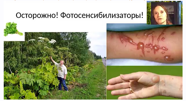 Солнцезащитные средства своими руками (Ольга Дзюбан)