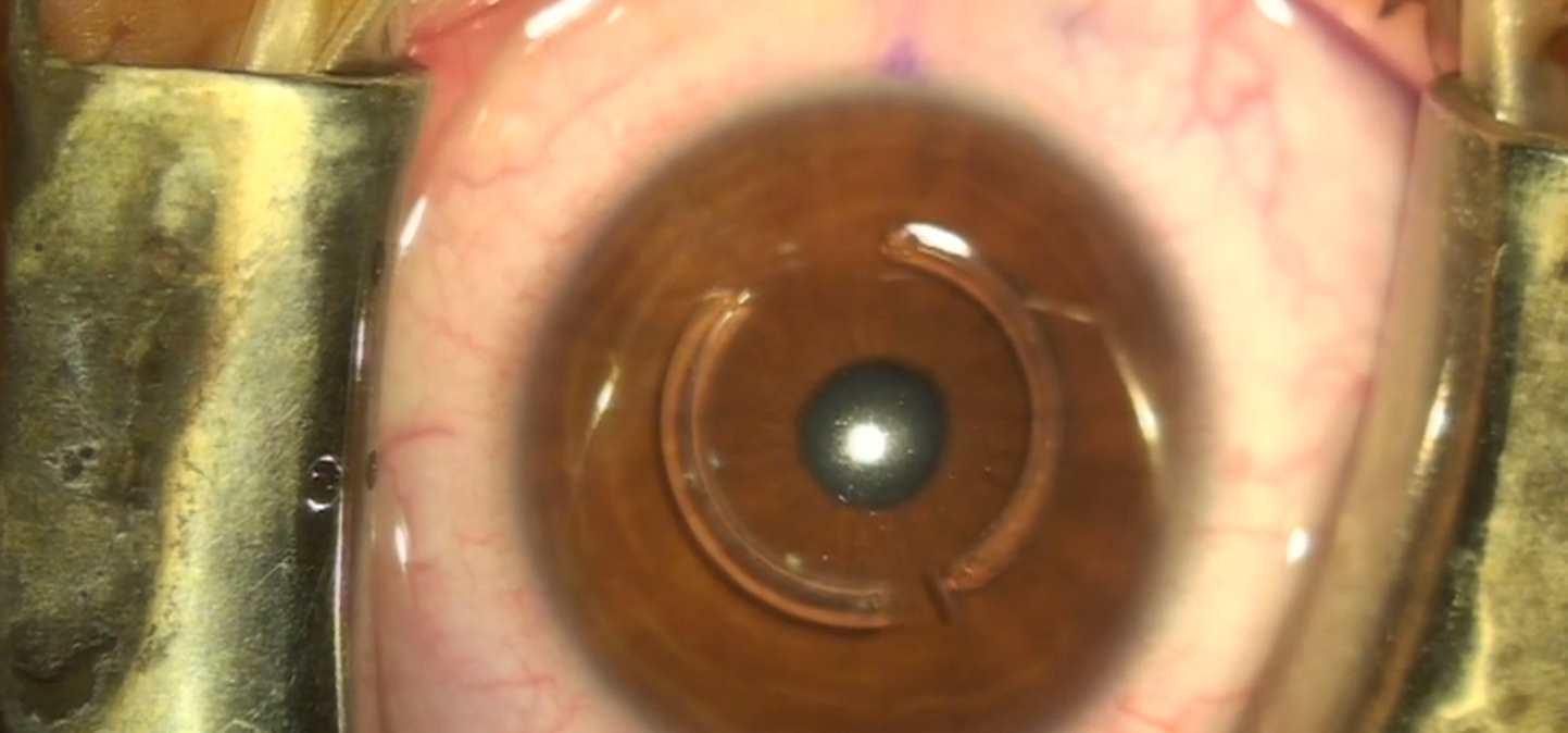 [Sigh Energy] Мощное исцеление и регенерация глаз I Eyes Healing and regeneration Powerful