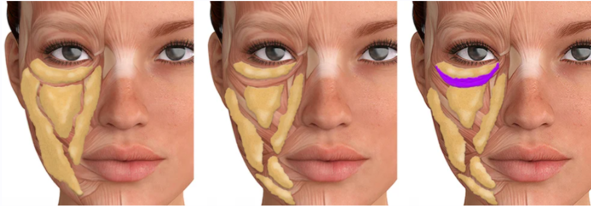 [Sigh Energy] Регулятор жира для лица | Facial fat regulator Powerful Plus +11x (Extra Strong)