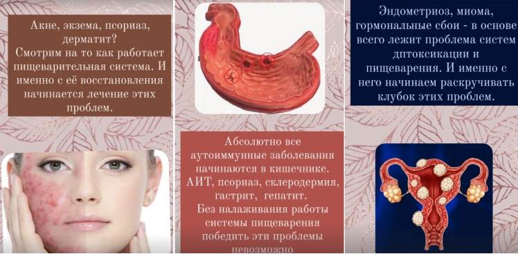 Здоровое пищеварение (Наталья Кондакова)