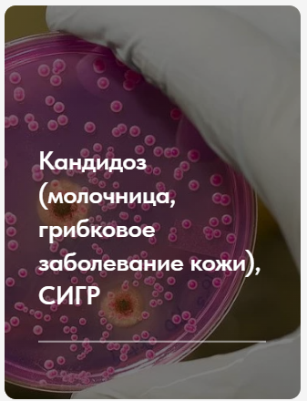 Лечебный протокол Кандидоз: молочница, грибковое заболевание кожи, сигр. Тариф без обратной связи (Елена Ержанова)