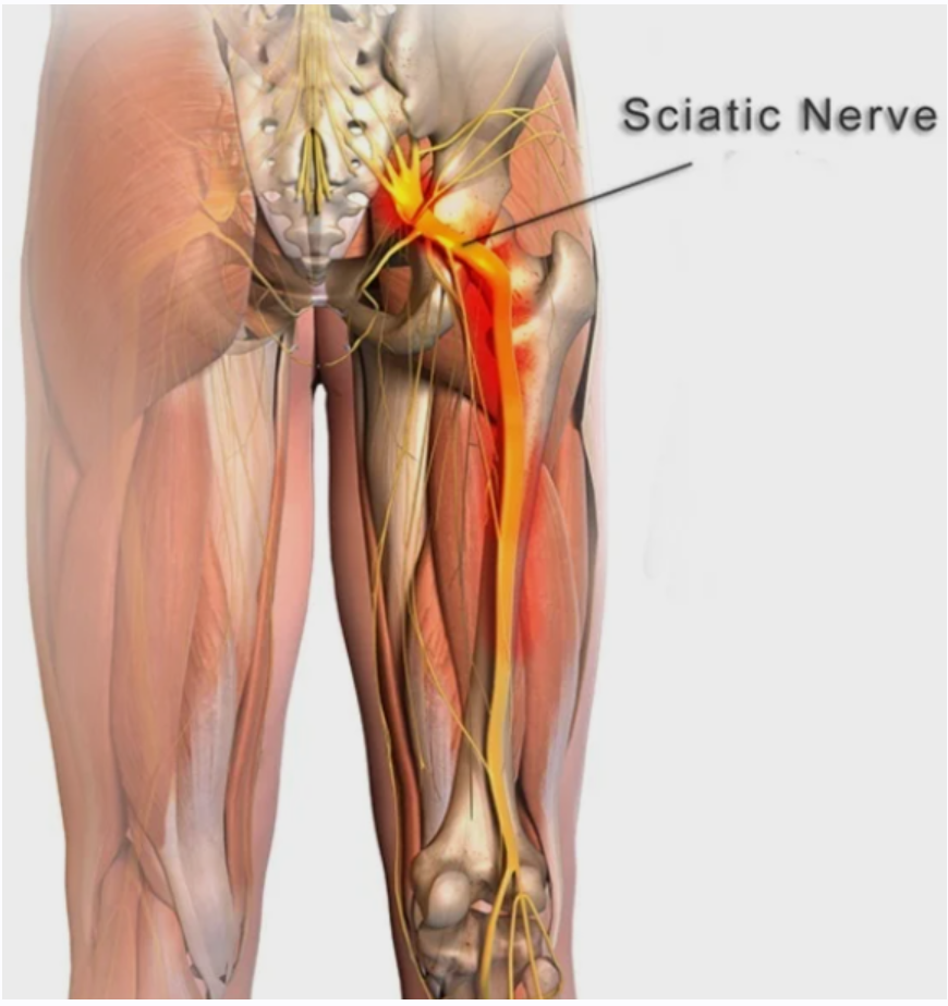 [Sigh Energy] Заживление и регенерация седалищного нерва | Sciatic Nerve Healing and Regeneration Powerful Plus +11x (Extra Strong)