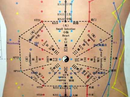 [Синофарм] Сахарный диабет. Осложнения сахарного диабета (Ван Вэй)