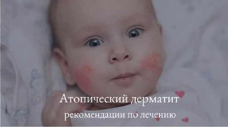 Про атопический дерматит от замечательного автора (Ольга Жоголева), фото 1 из 1.