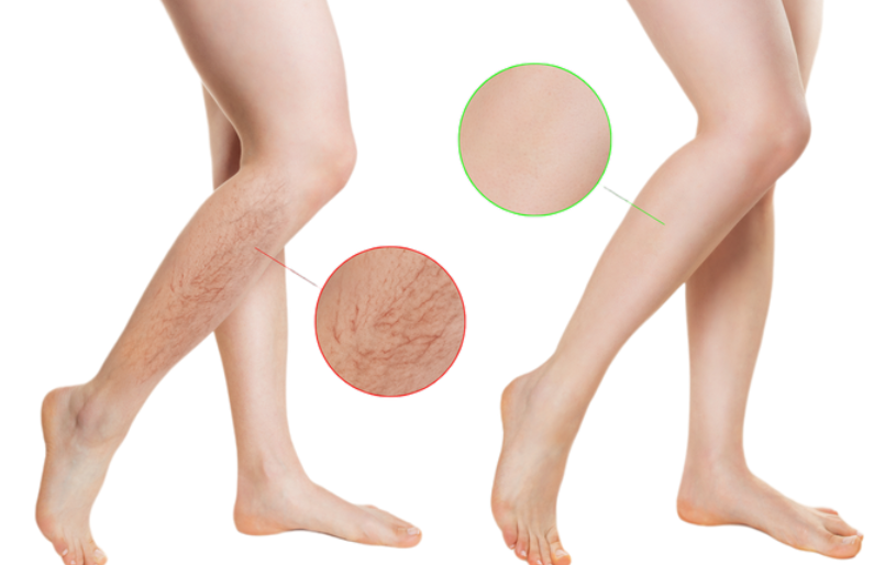 Секреты здоровых ног. Пакет «Минимум»  (Александра Бонина)