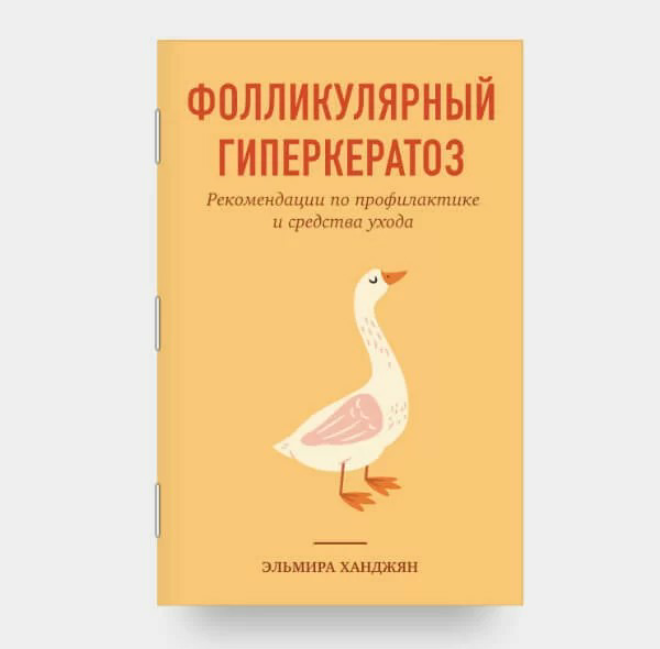 Фолликулярный гиперкератоз (Эльмира Ханджян)