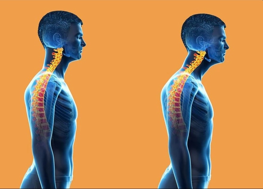 [Sigh Energy] Мощная коррекция положения головы | Forward Head Posture correction Powerful Plus +11x