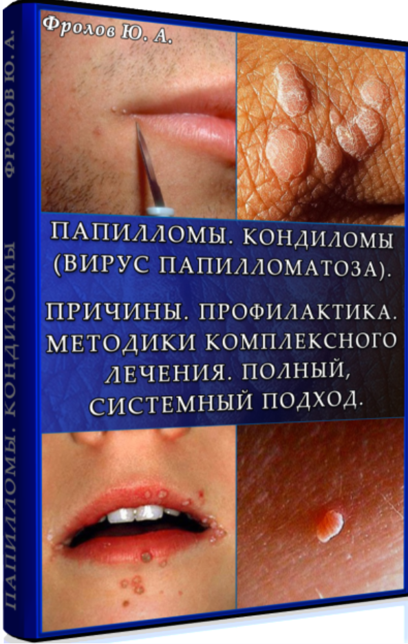 Папилломы. Кондиломы (вирус папилломатоза). Причины. Профилактика. Методики комплексного лечения (Юрий Фролов)