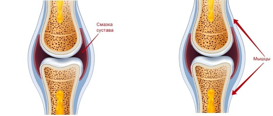 Здоровье суставов ног от А до Я. Тариф Минимум (Александра Бонина)