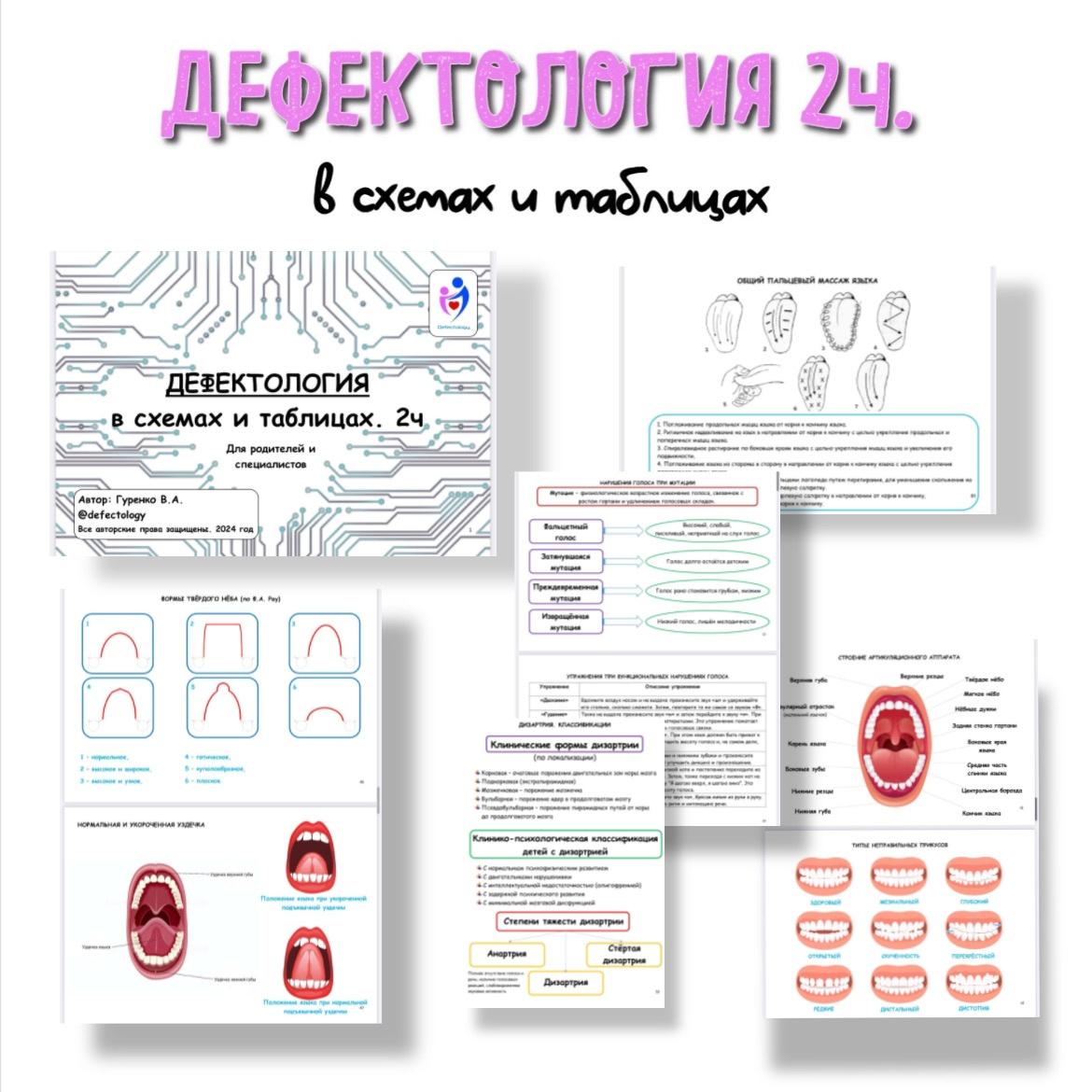 Дефектология в схемах и таблицах 2 часть (Виктория Гуренко)