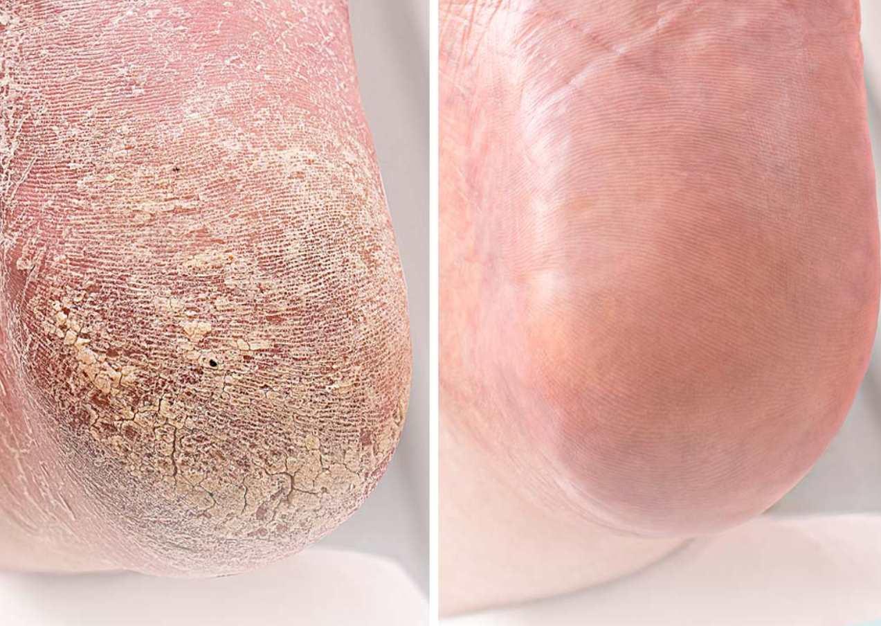 Вебинар Трещины – это просто. Тариф Pro (Ангелина Нышонкова)