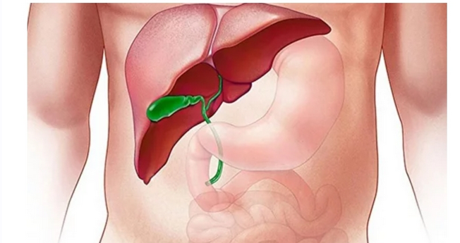 [Доктор Плесовских] Годовая программа лечения желчного при стойких запорах (Татьяна Плесовских)