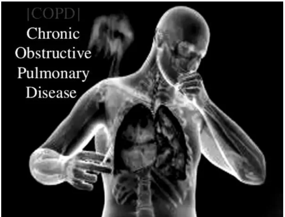 [Sigh Energy] Хроническая обструктивная болезнь легких. Заживление и регенерация. Chronic Obstructive Pulmonary Healing and Regeneration