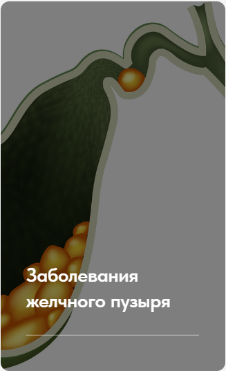 Заболевания желчного пузыря. Тариф Без обратной связи (Елена Ержанова)