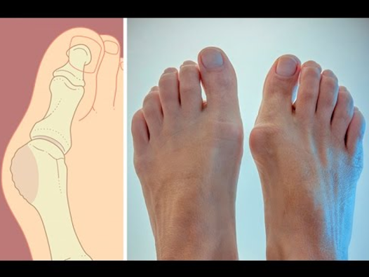 Секреты антикосточки и греческой стопы (Алексей Маматов)