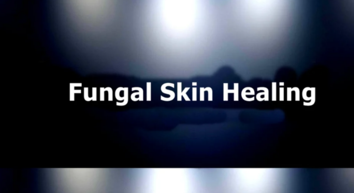 [Sigh Energy] Грибковое заживление кожи. Fungal Skin Healing Powerful Plus +11x (Extra Strong)