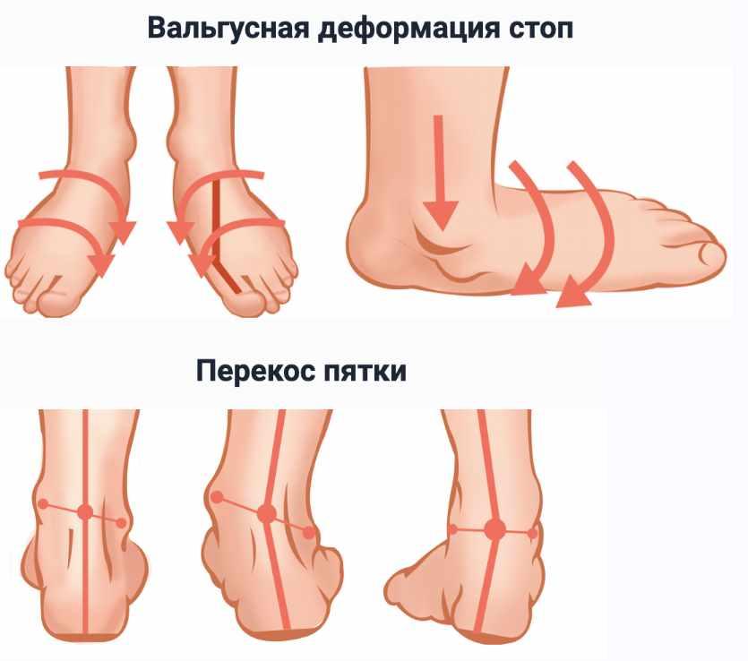 Стопа. Инструкция по применению