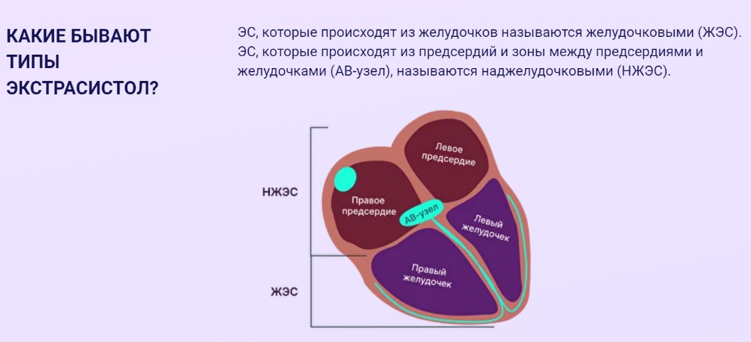 Управление экстрасистолией (Мария Чайковская)