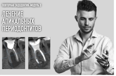Повторная эндодонтия. Модуль 3: Лечение апикальных периодонтитов (Дмитрий Николаев)