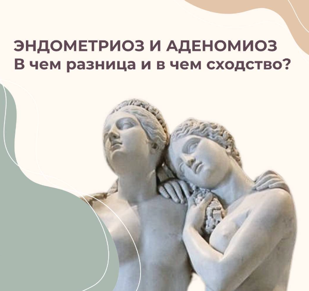 Эндометриоз (Элисо Джобава)