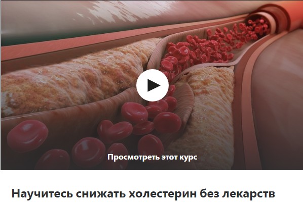 [Udemy] Научитесь снижать холестерин без лекарств (Михаил Петрик)