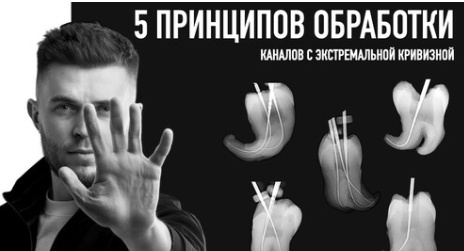 5 принципов обработки каналов с экстремальной кривизной (Дмитрий Николаев)