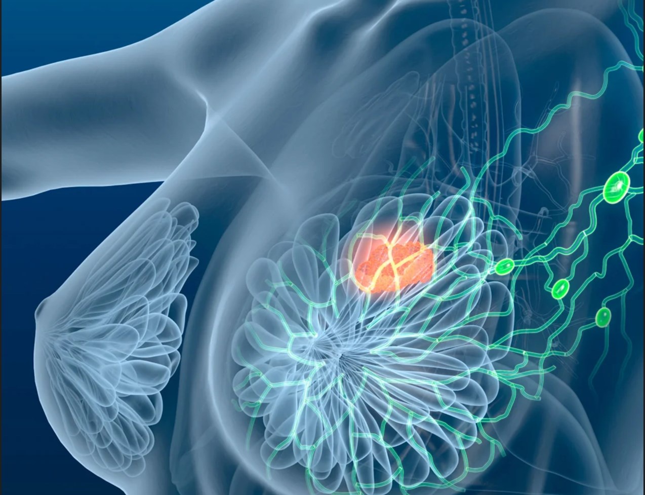 Методика проведения маммографии (Мария Трофимова)