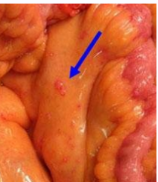 Аюрведический подход к лечению рака (Манохар Палакурти, Виктория Кощеева)