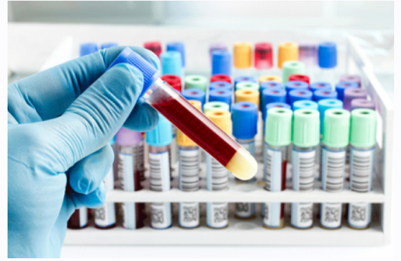 [Школа долголетия] Ранняя диагностика и профилактика рака (Михаил Батин, Дмитрий Веремеенко)