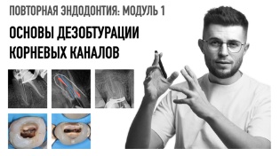 Повторная эндодонтия. Модуль 1: Основы дезобтурации корневых каналов (Дмитрий Николаев)