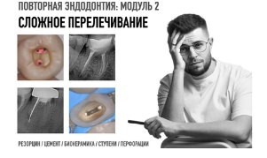 Повторная эндодонтия. Модуль 2: сложное перелечивание (Дмитрий Николаев)