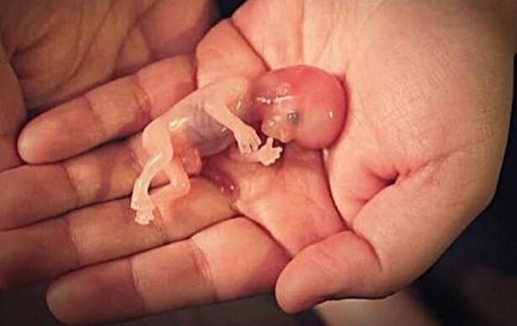 Семинар "Аборты, выкидыши, мертворождения - исправление последствий" (Светлана Соколова)