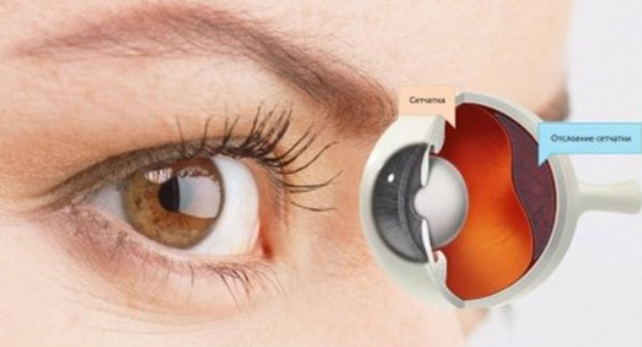 Восстановление сетчатки. Тариф Самостоятельный (Людмила Лазарева)